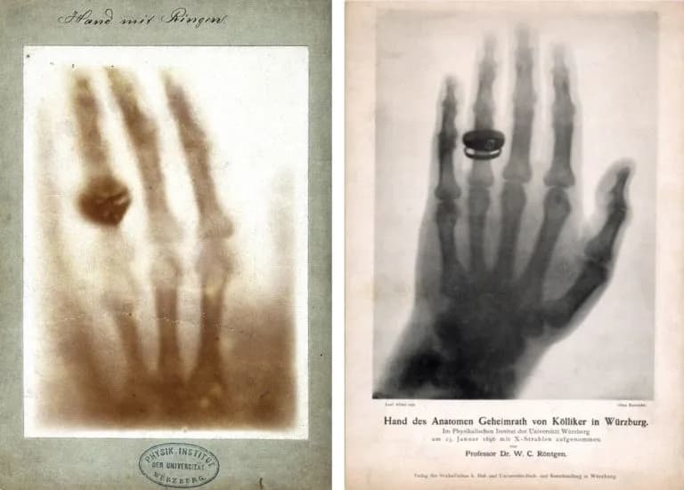 Kto wynalazł promienie X? Historia odkrycia, które zmieniło medycynę na zawsze